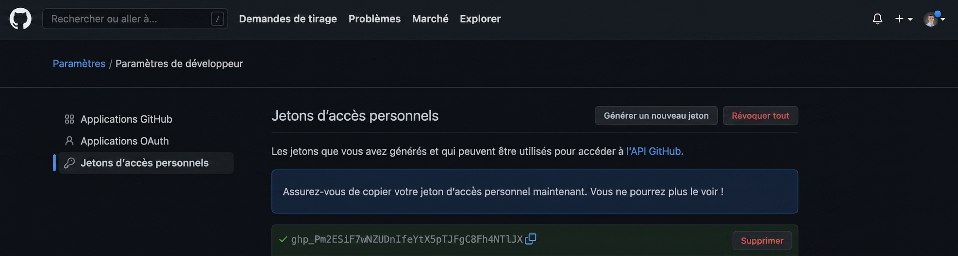 PAT affiché comme un mélange de lettres et de chiffres, que l'on peut copier