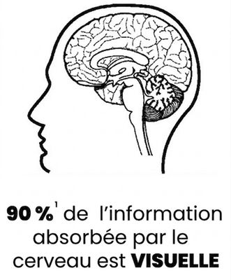 Image d'un cerveau humain