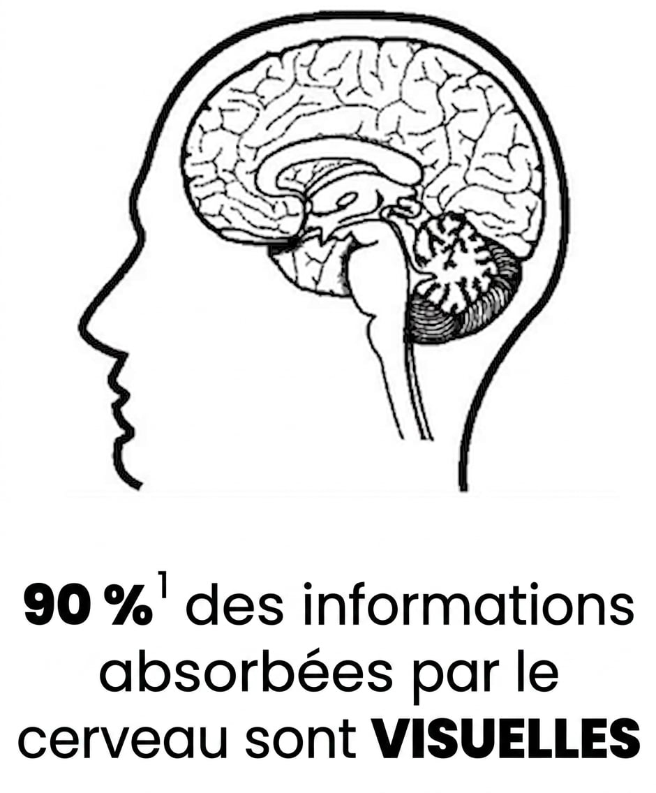 Une image d’un cerveau humain