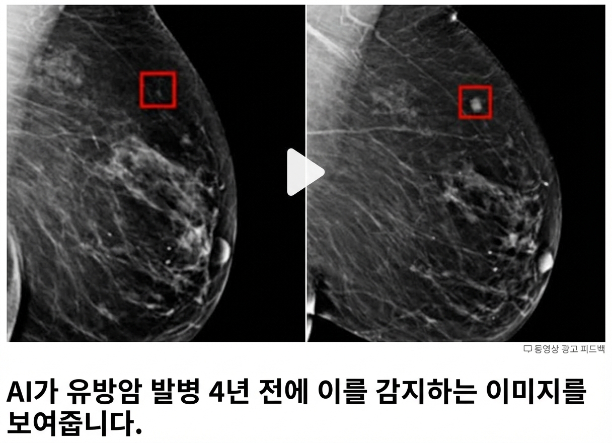 성장 단계가 다른 두 종양이 보이는 유방 X선 이미지