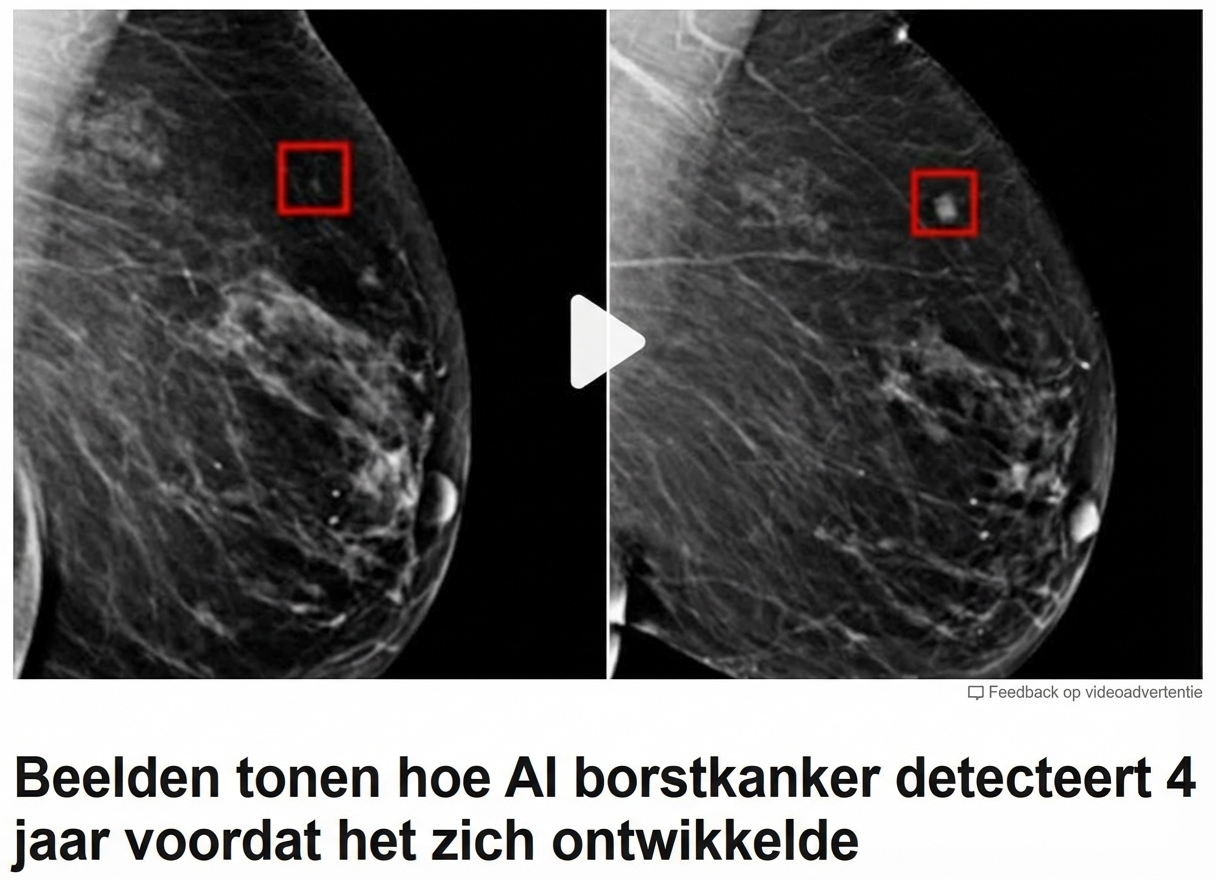 Een borst-röntgenfoto met twee tumoren in verschillende stadia