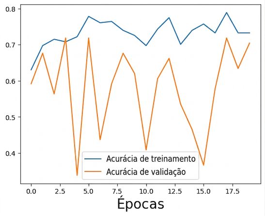 regularização excessiva
