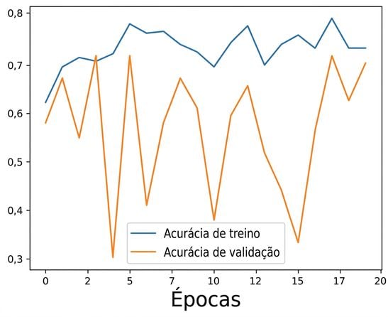 regularização excessiva