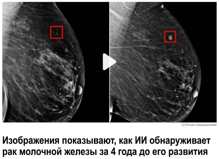 Рентгеновский снимок груди с двумя опухолями на разных стадиях роста.