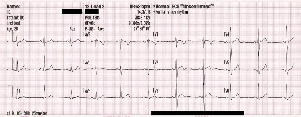 A single patient's ECG is typically recorded on a piece of paper as a time-series.