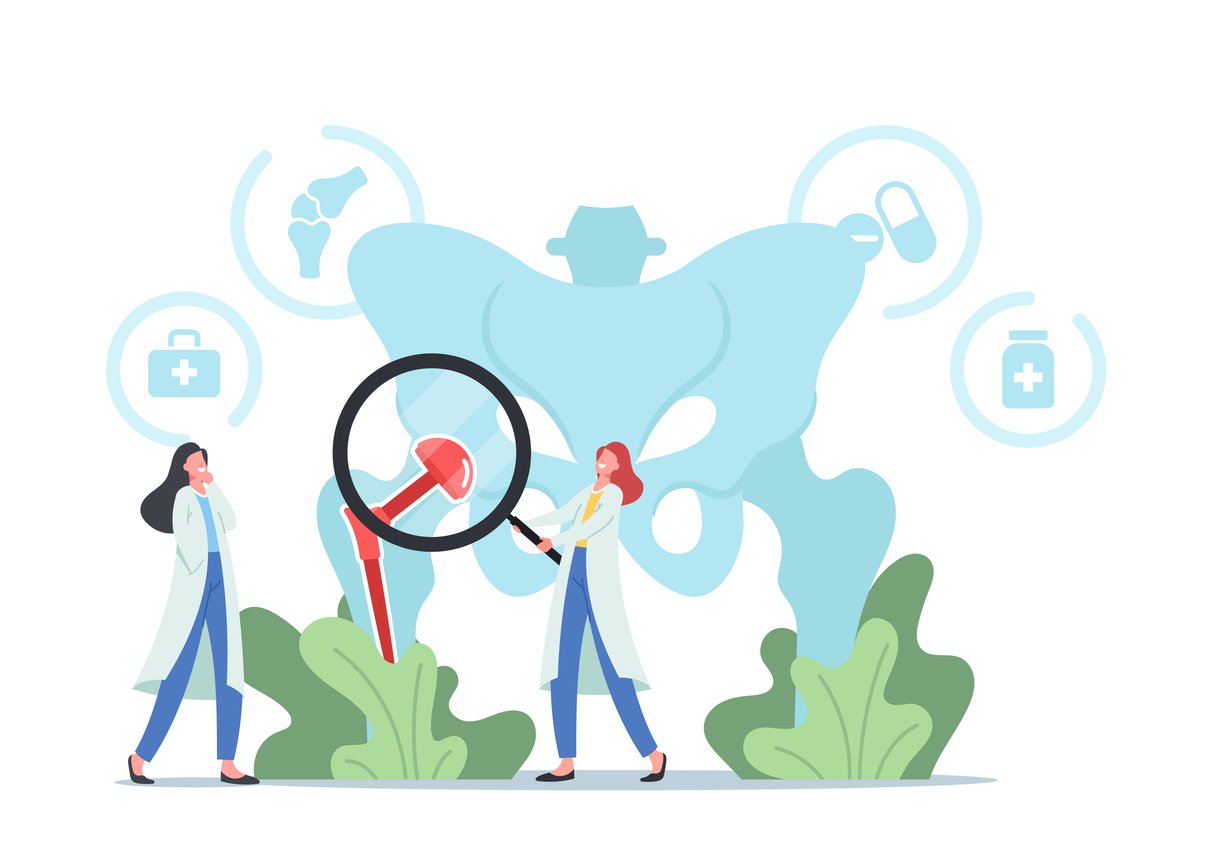 doctor characters with magnifying glass viewing human pelvic bones with hip prosthesis