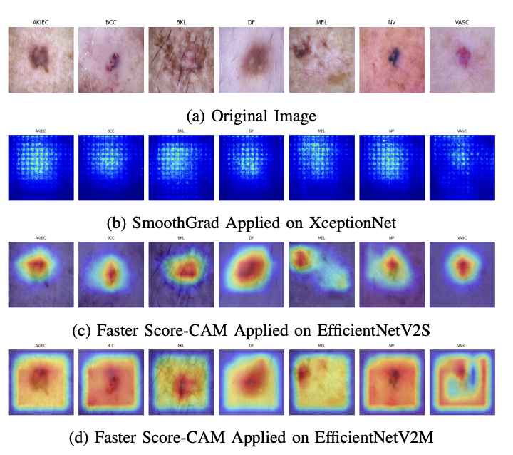 graphic showing detection of skins lesions through the usage of AI